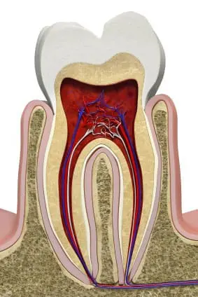 Bone Grafting | Pinnacle Oral Surgery Specialist | Rockwall & Sulphur Springs