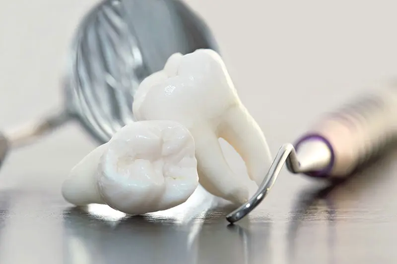 Tooth Extractions | Pinnacle Oral Surgery Specialist | Rockwall & Sulphur Springs