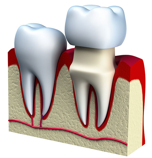 Dental Trauma | Pinnacle Oral Surgery Specialist | Rockwall & Sulphur Springs