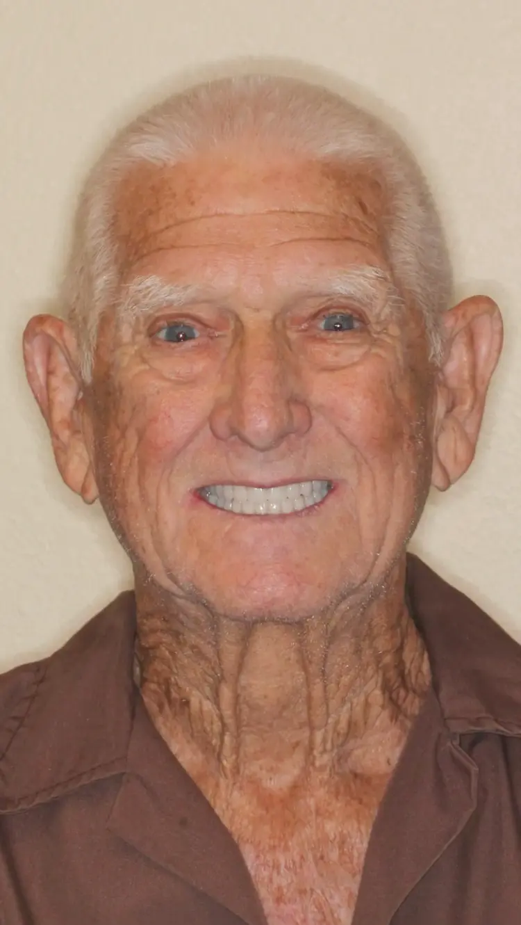 All On X Teeth In A Day Pinnacle Oral Surgery Thumbnail