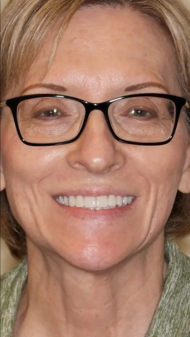 All On X Teeth In A Day Pinnacle Oral Surgery Thumbnail