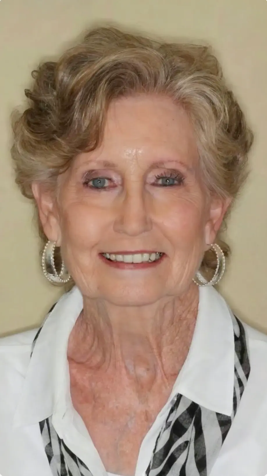 All On X | Teeth In A Day Case Part 1 & 2 | Pinnacle Oral Surgery