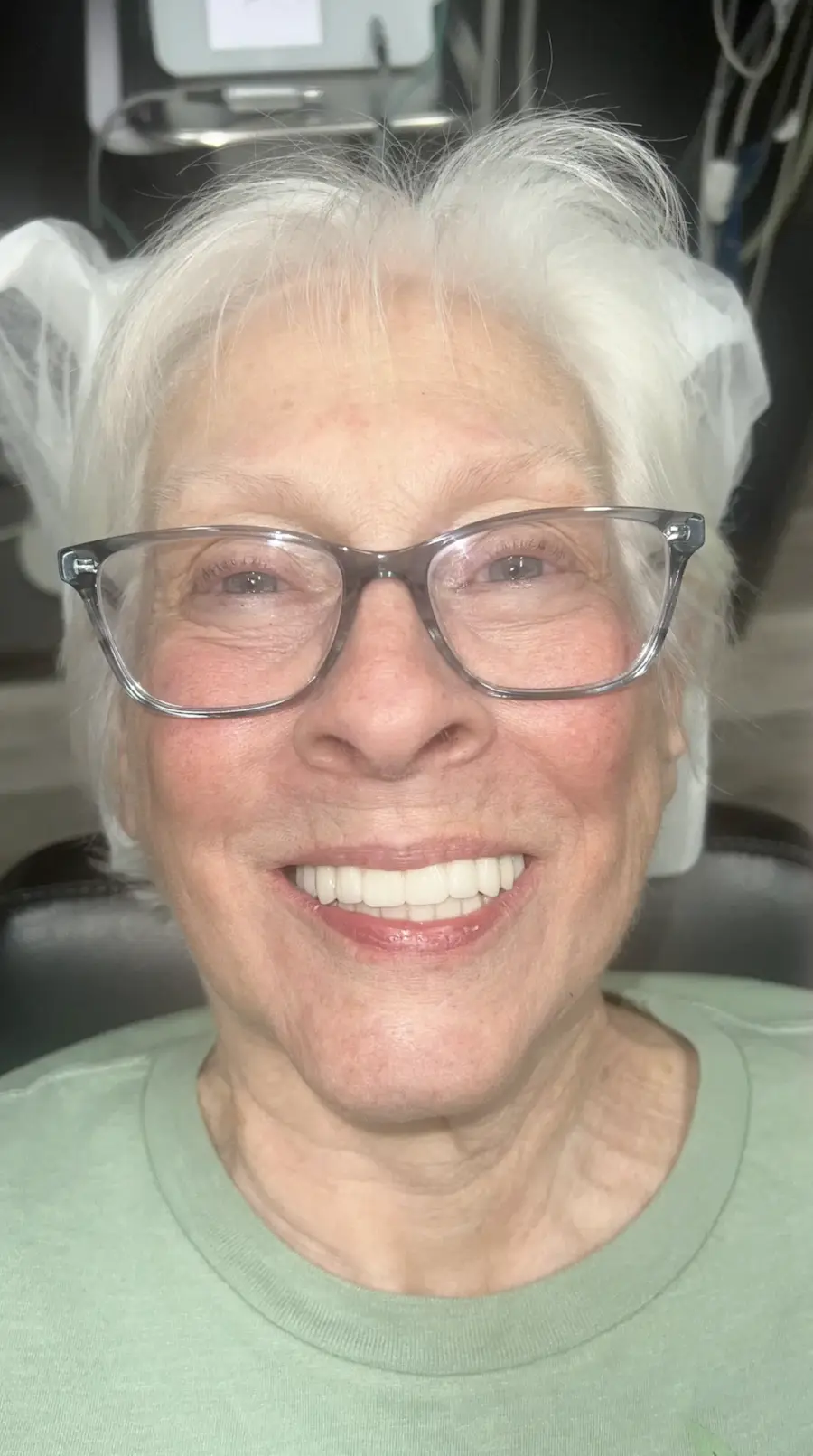 All On X | Teeth In A Day Case MP | Pinnacle Oral Surgery
